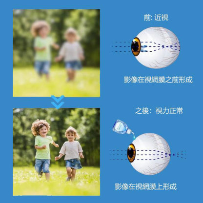 即時矯正眼睛清晰視力清滴眼液