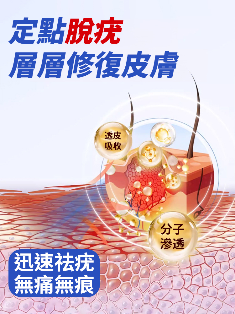 【3天見效】祛疣型醫用凝膠