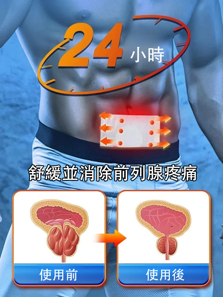 頻尿急前列腺炎穴位貼