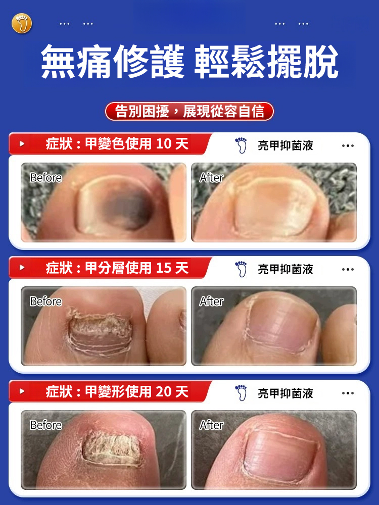 香港大藥局亮甲抑菌液