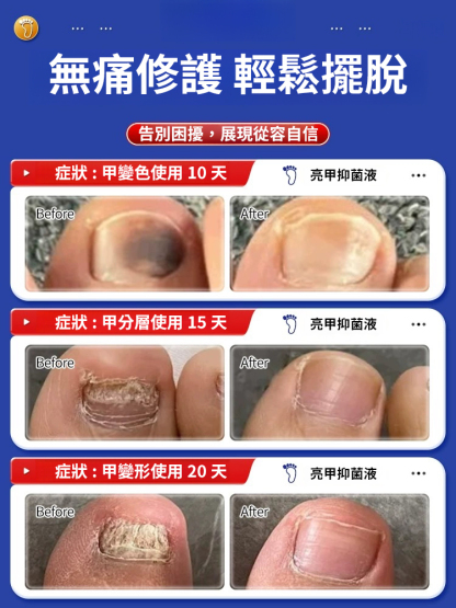 香港大藥局亮甲抑菌液