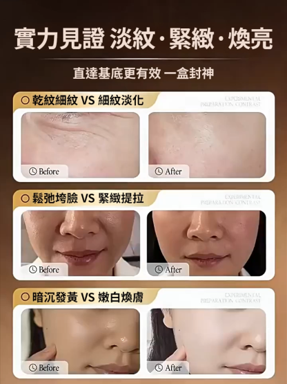 7天撫平魚尾紋！草本抗老神霜一抹逆齡，眼周緊到能彈硬幣，暗沉浮腫瞬間消失，一瓶搞定眼周衰老，讓媽媽重返年輕！