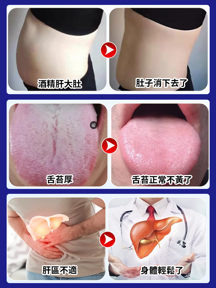 香港時珍大藥局水飛薊人參佛手貼