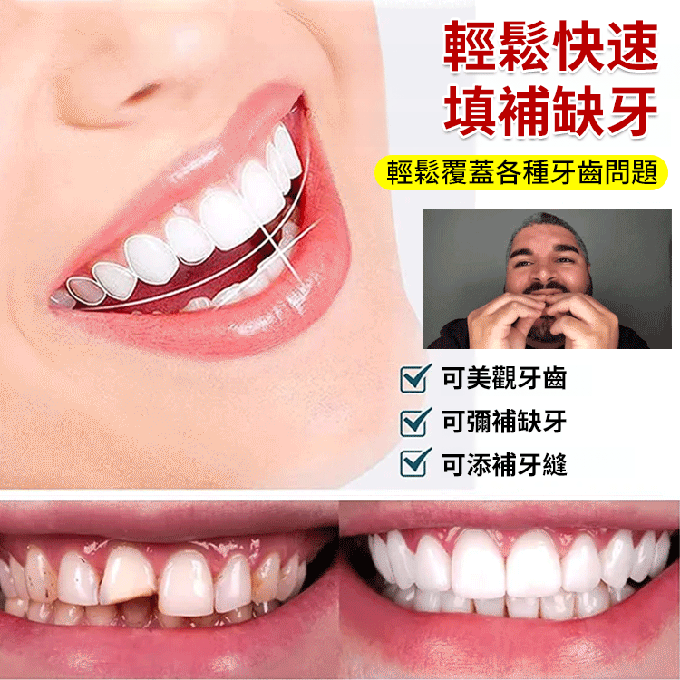 SorriBem完美微笑假牙