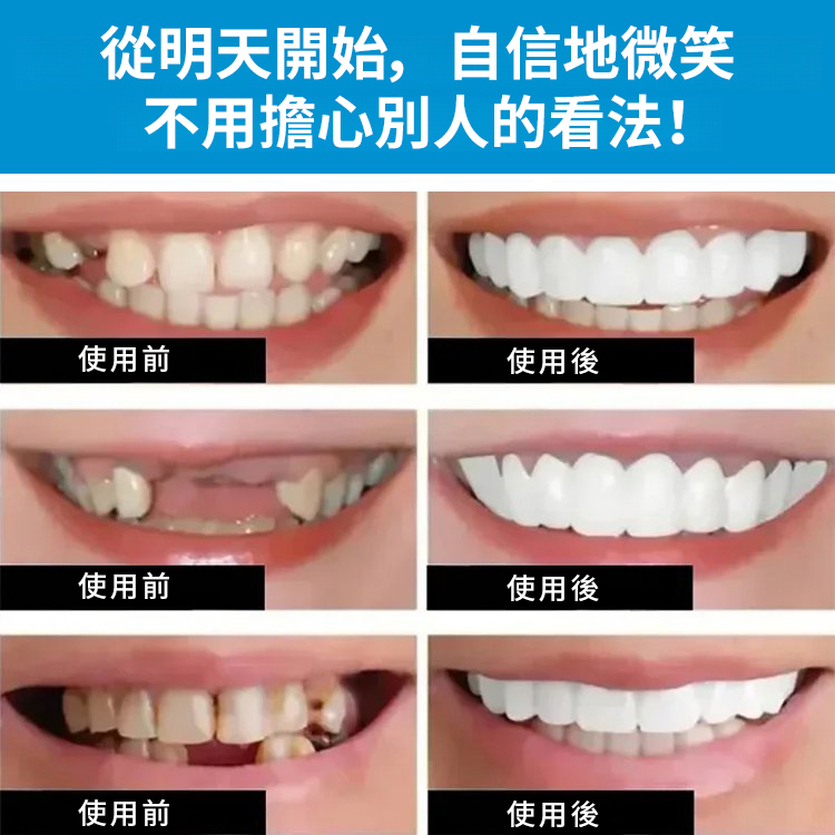 SorriBem完美微笑假牙
