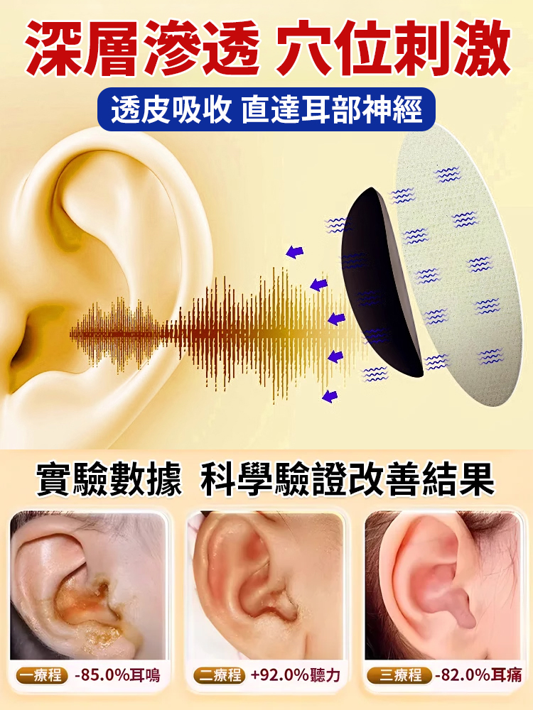 耳康舒穴位貼