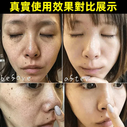 白白日記美白祛斑洗面乳