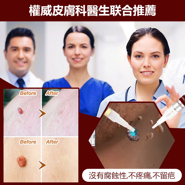 克疣液筆