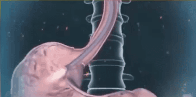 2cac7bbd0bdfaa6c3ca35221d2fd5b0f.gif