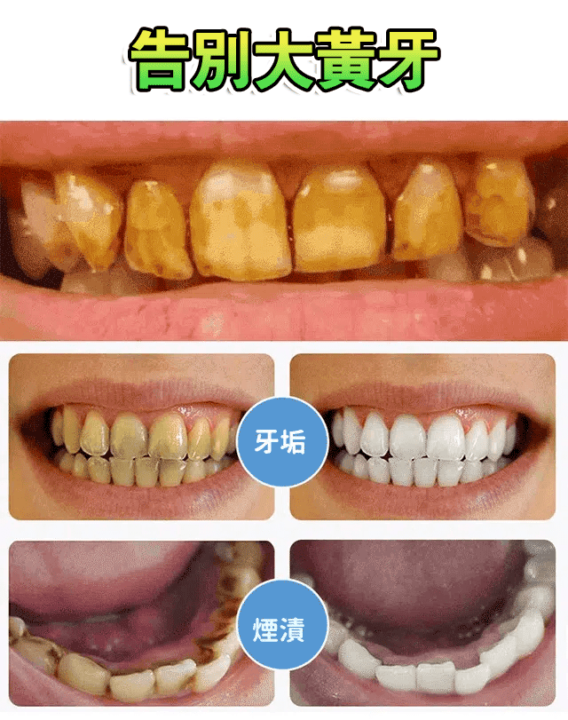 竹炭潔白牙膏