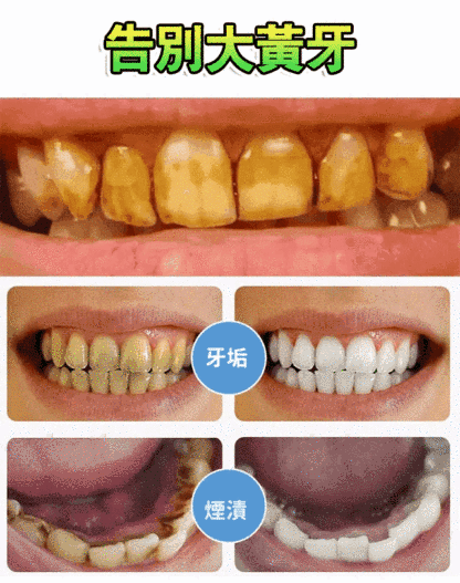 竹炭潔白牙膏