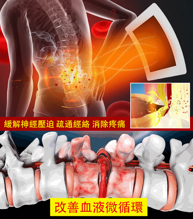 蒙澳神遠紅外腰椎貼-強力滲透，快速起效，給腰椎全方位的呵護，讓您的腰椎重獲活力