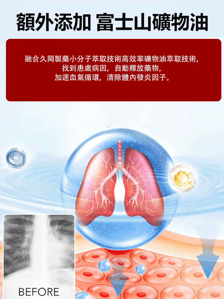 【止咳清痰】醫用穴位貼緩解支氣管炎清肺