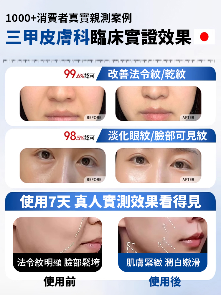 抗皺緊緻法令紋貼