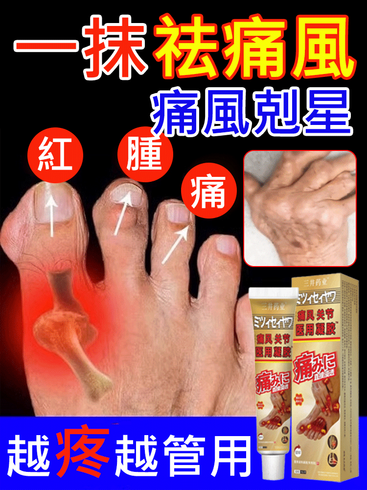 痛風剋星-三井關節遠紅外線治療凝膠