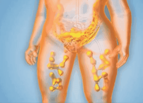 9d134d7805124c9c94f7e3d22dcf38ef.gif