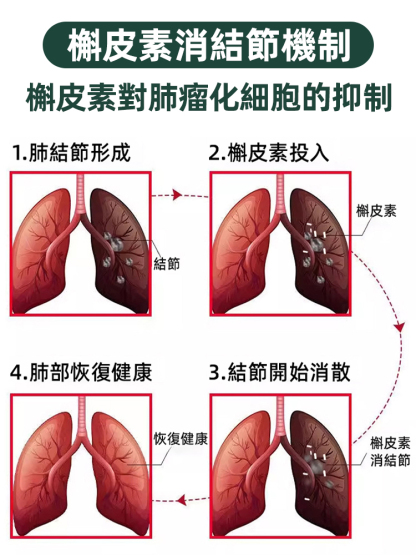 【專攻喉嚨不適】草本植物萃取噴劑