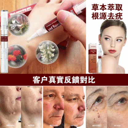 克疣液筆