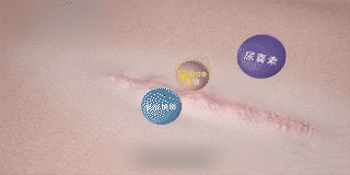 03.gif