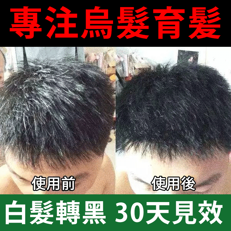 30天白髪轉黑髪烏髪噴劑