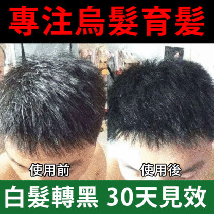 30天白髪轉黑髪烏髪噴劑