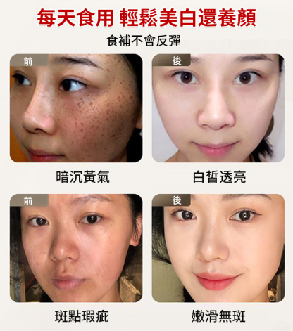 美味高蛋白高原炒杏仁