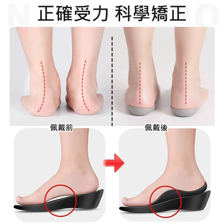 足外翻矯正隱形鞋墊