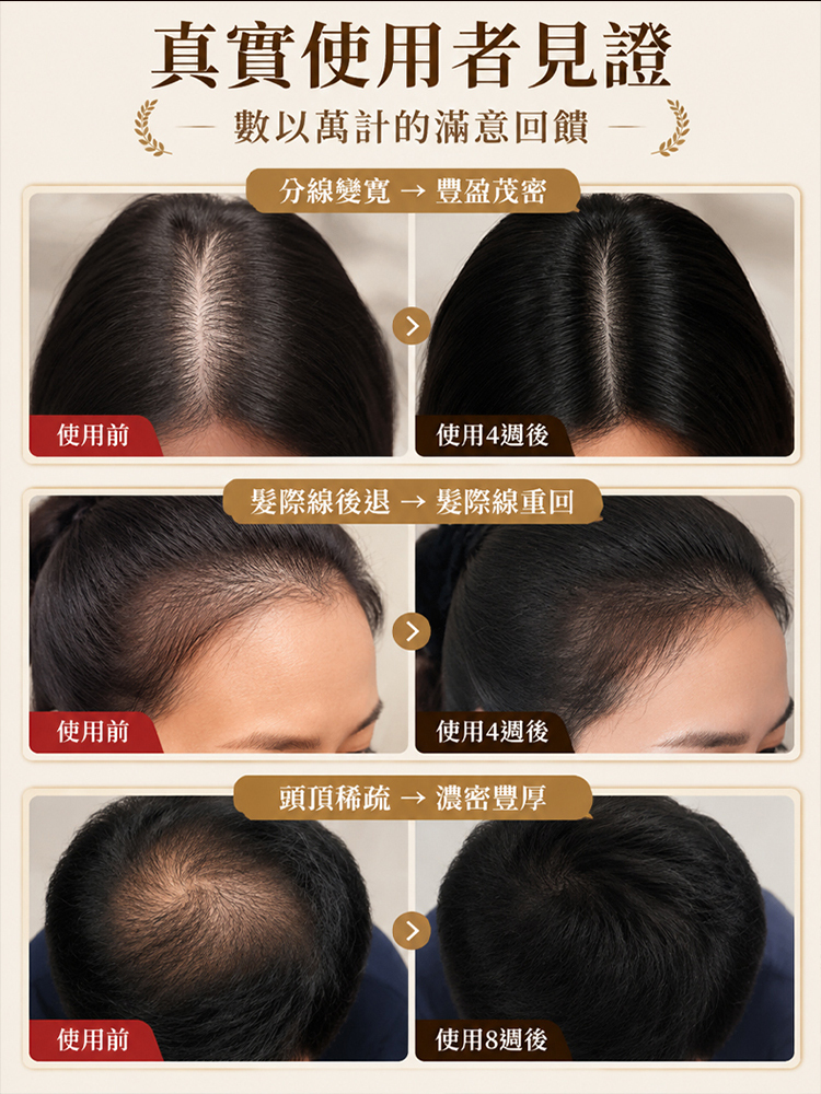 防脫固發精華液