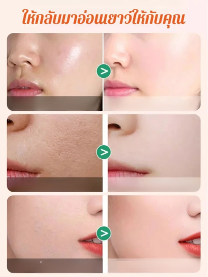 ครีมปรับสีผิว วิตามินซีห้าเท่า