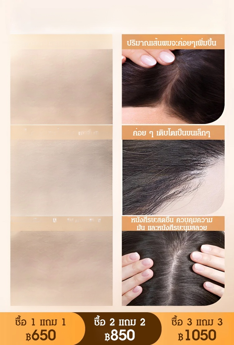 [สมุนไพรบำรุงเส้นผม] แชมพูป้องกันผมร่วง