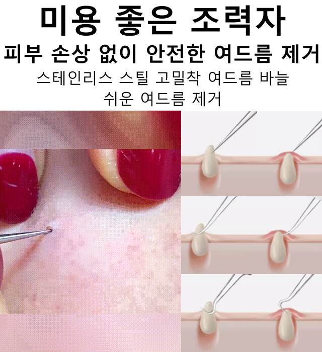 고정밀 고경도 세포 집게