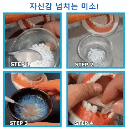 South Moon 임시 구강용 접착제