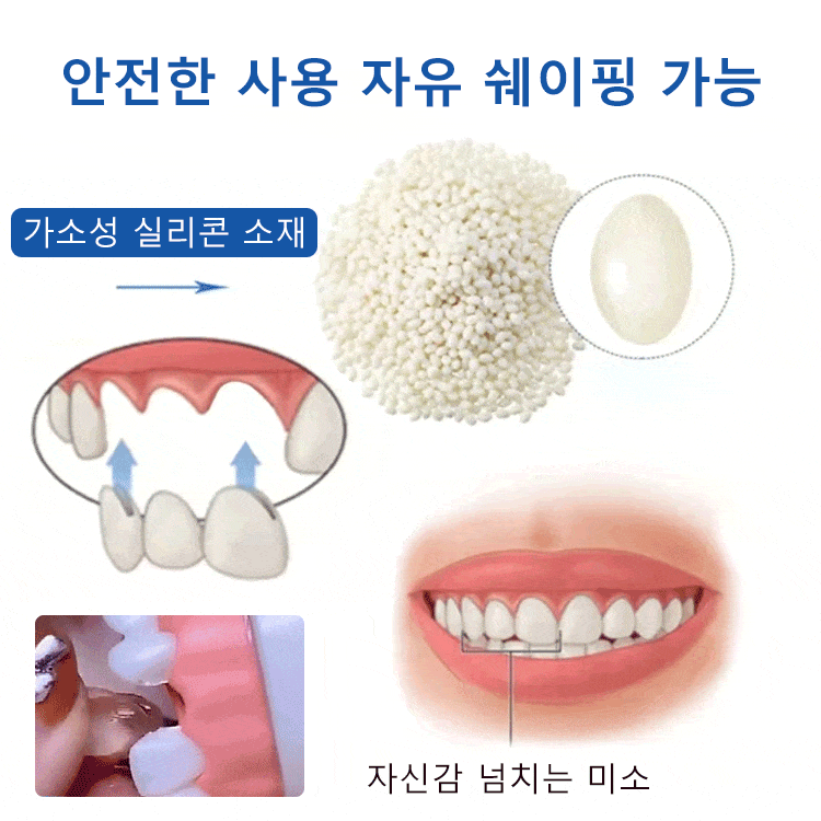 South Moon 임시 구강용 접착제