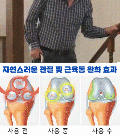 전수입 칠레산 체리 씨앗 