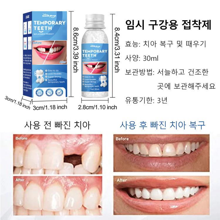 South Moon 임시 구강용 접착제