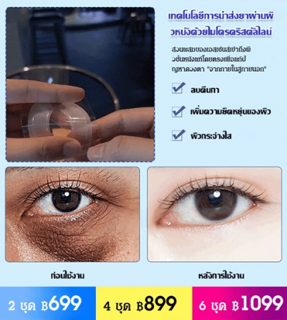 แผ่นแปะตาไมโครนีดเดิลไฮยาลูโรนิกแอซิด