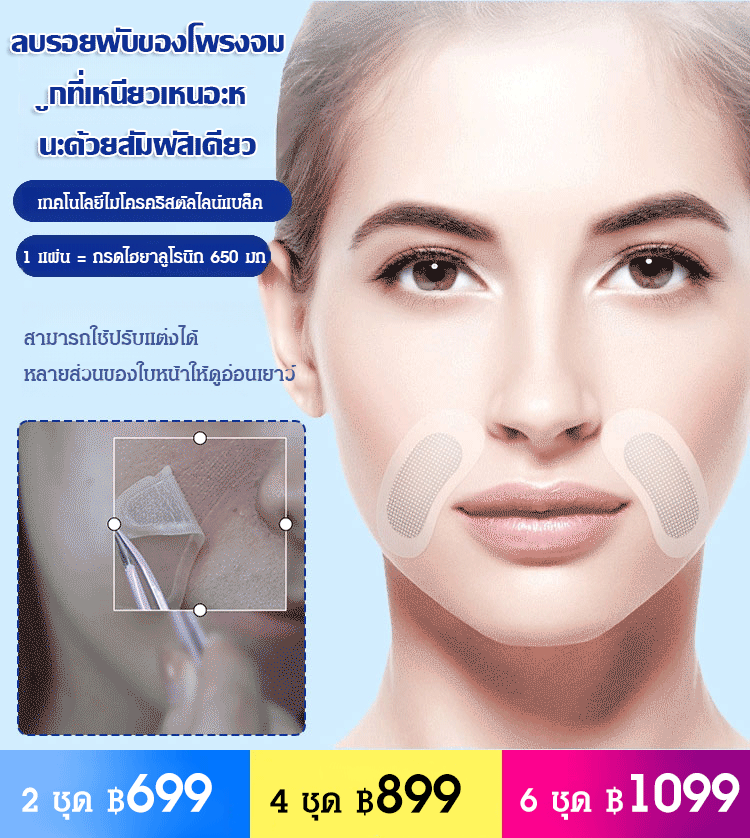 แผ่นแปะตาไมโครนีดเดิลไฮยาลูโรนิกแอซิด