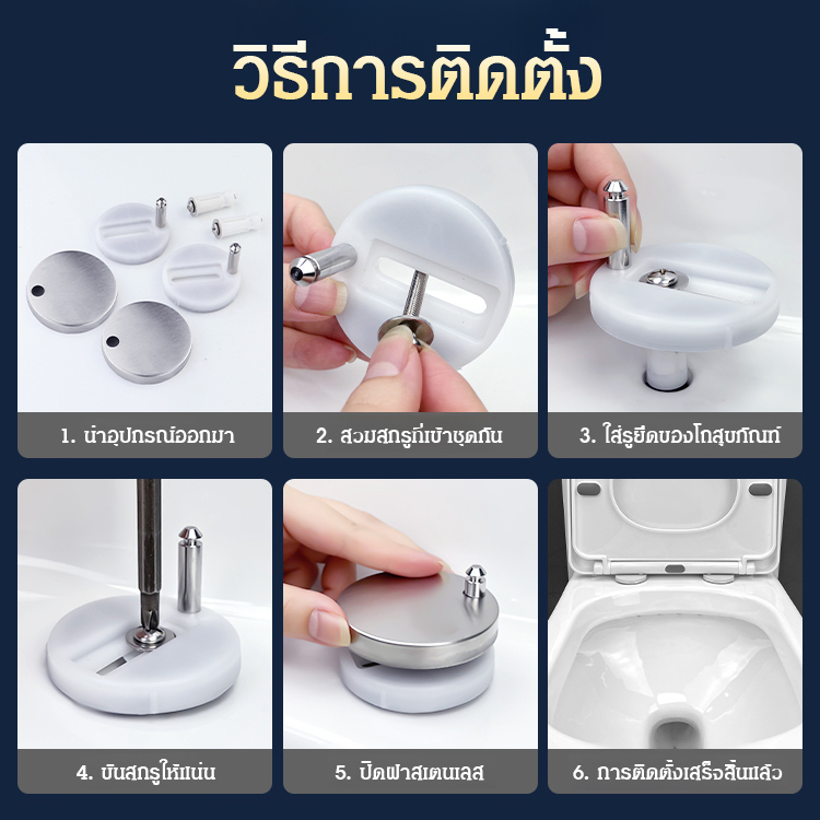 ฝาชักโครกอุปกรณ์เสริมสกรูยึดขา QQ อุปกรณ์เสริมฝาครอบขยายทั่วไปสลักเกลียวที่นั่งชักโครกตัวยึดแบบขึ้นล