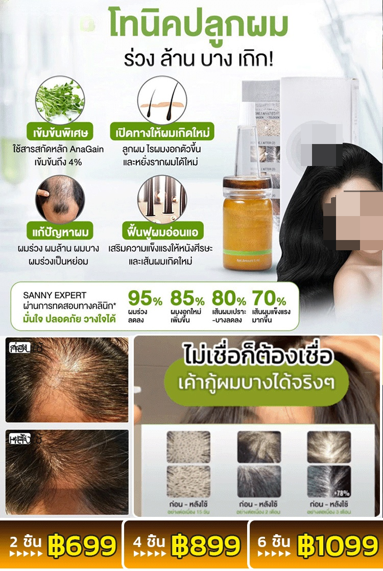 [การวิจัยพิเศษ] เซรั่มเข้มข้นปลูกผมป้องกันผมร่วง