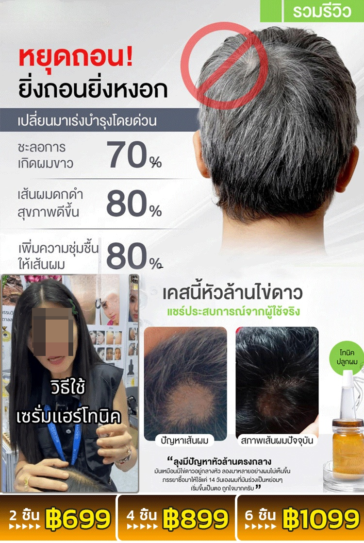 [การวิจัยพิเศษ] เซรั่มเข้มข้นปลูกผมป้องกันผมร่วง