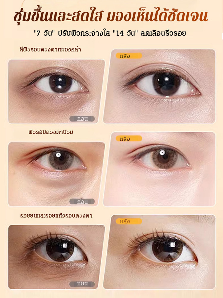 น้ำมันเซรั่มลูทีนกระชับผิวรอบดวงตา