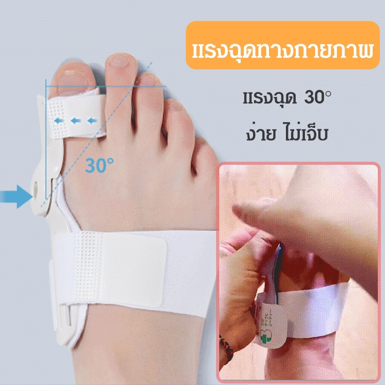 (แนะนำโดยแพทย์) อุปกรณ์แก้ไขนิ้วโป้งโค้งงอ เหมาะสมทั้งชายหญิง