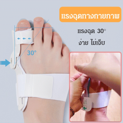 (แนะนำโดยแพทย์) อุปกรณ์แก้ไขนิ้วโป้งโค้งงอ เหมาะสมทั้งชายหญิง