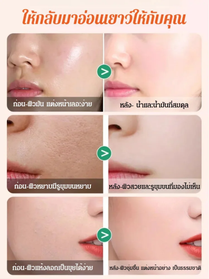 ครีมปรับสีผิว วิตามินซีห้าเท่า