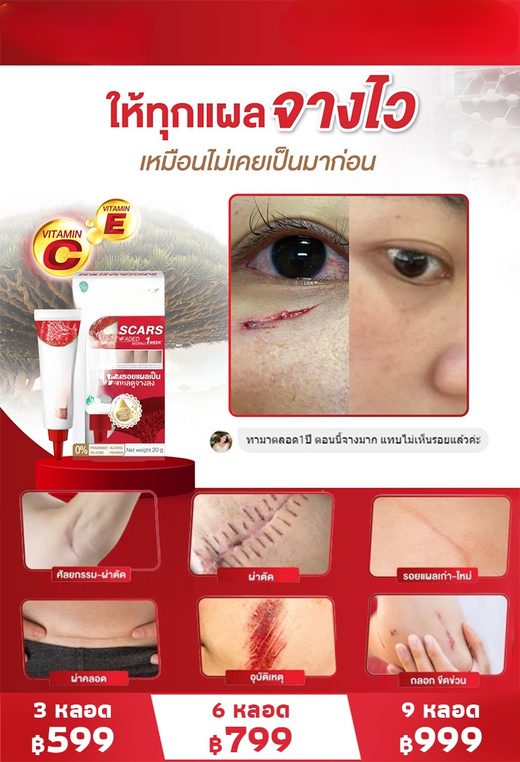 เจลลดรอยแผลเป็นทางการแพทย์