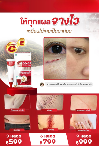 เจลลดรอยแผลเป็นทางการแพทย์