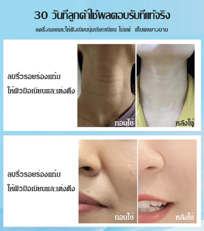 เครื่องนวดยกกระชับใบหน้า