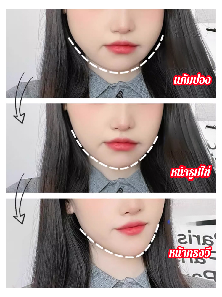 【หน้าทรงวีเล็กใน 1 สัปดาห์】เครื่องกระชับหน้าเรียวความถี่สูง