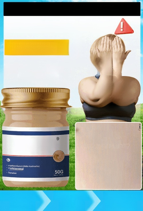 【เห็นผลทันที! รักษาถาวร!】ครีมรักษาโรคด่างขาว