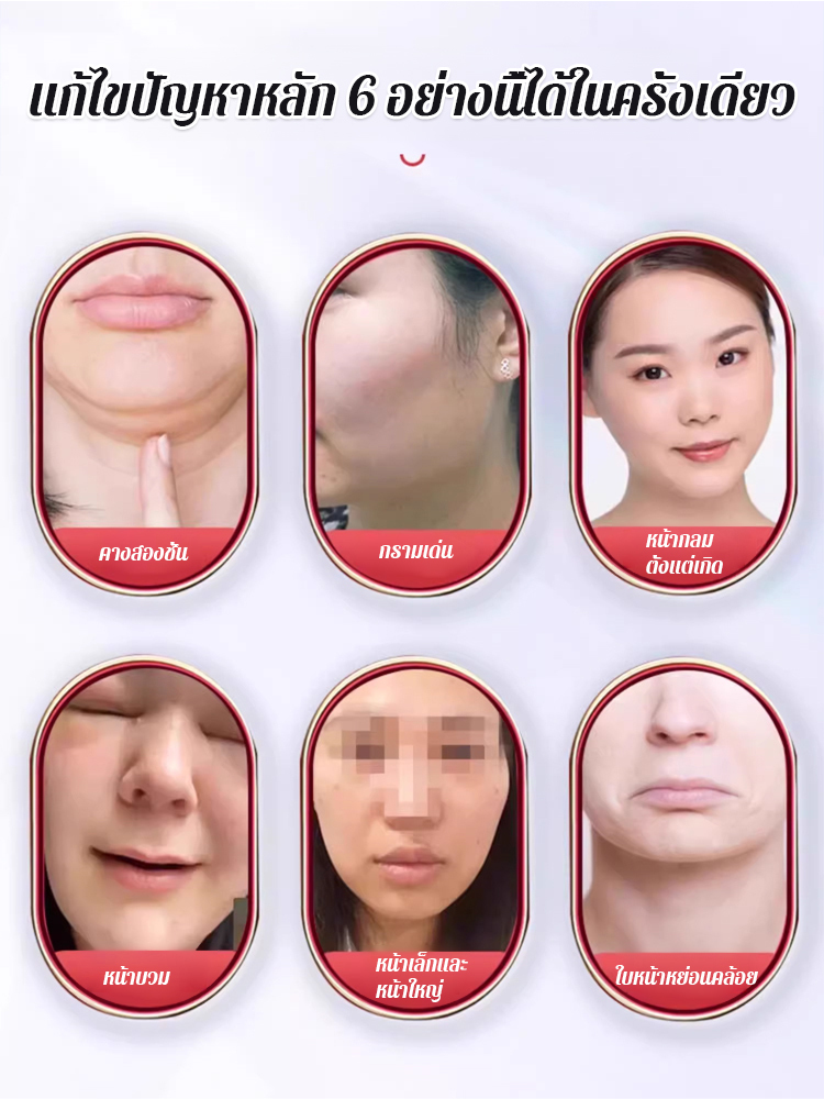 【หน้าทรงวีเล็กใน 1 สัปดาห์】เครื่องกระชับหน้าเรียวความถี่สูง